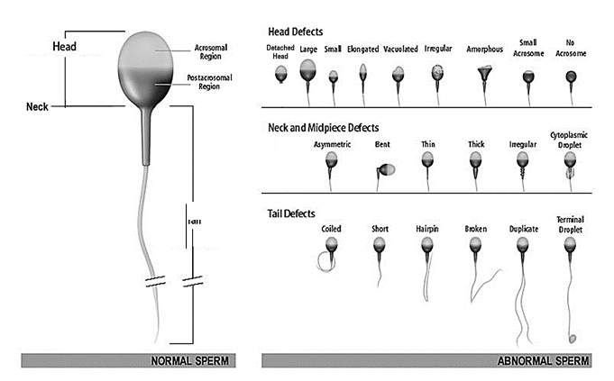 Sperm Semen Sperm Morphology Sperm Shape